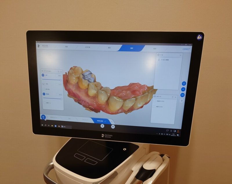 当院のセラミック治療について