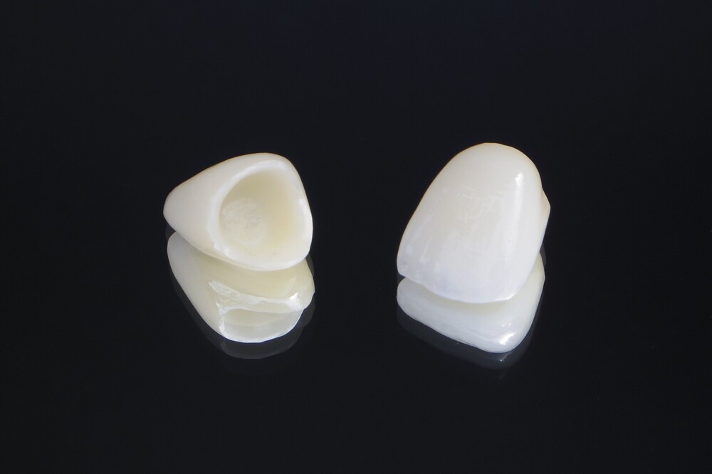 ジルコニアセラミック