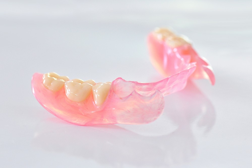 ノンクラスプデンチャー